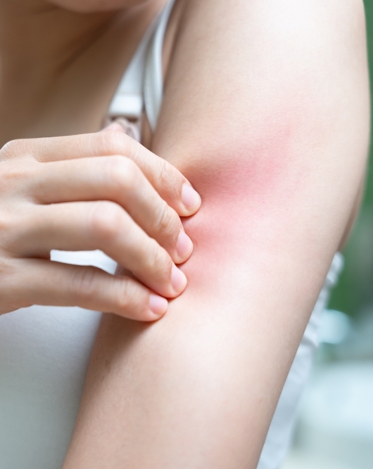 woman itching irritated skin